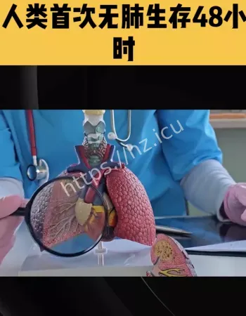 无肺生存48小时